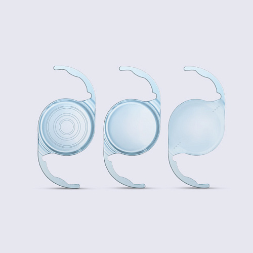 Памятка пациенту - рефракционная замена хрусталика